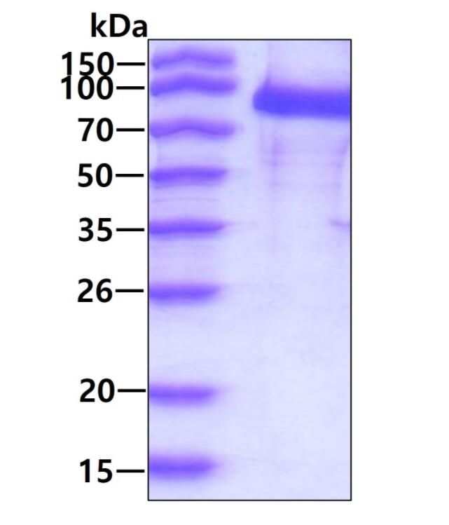 3 μg by SDS-PAGE under reducing condition and visualized by coomassie blue stain